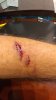 Cut Arm.jpg